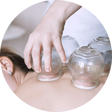 Cupping Therapy | Oriental Remedies