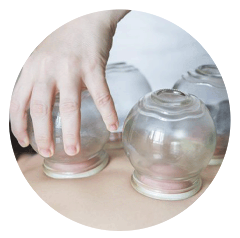 Cupping | Oriental Remedies