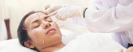 Is Facial Acupuncture The New Botox? | Oriental Remedies