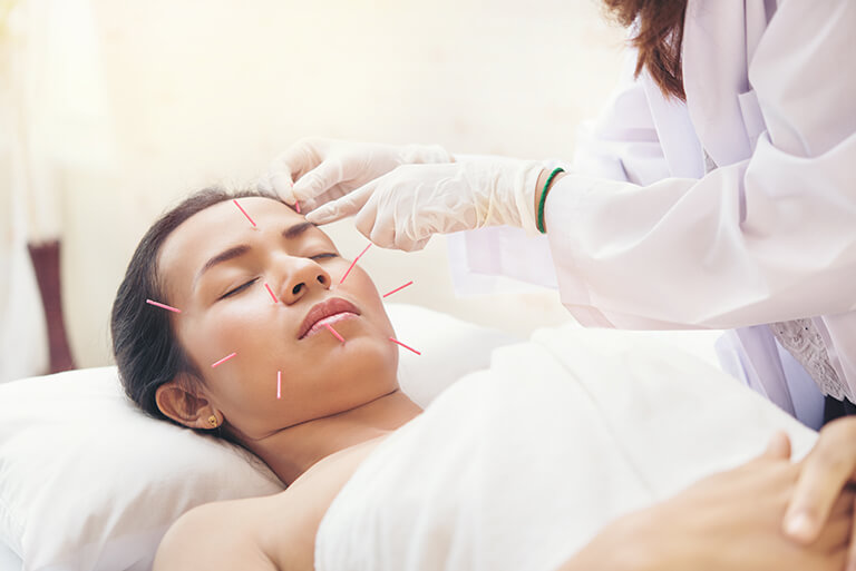 Facial Acupuncture Can Help You Achieve Firmer Youthful Skin | Oriental  Remedies