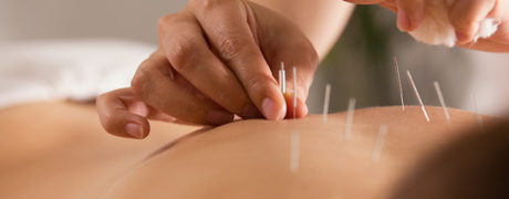 Improve Your IVF Success Rate With Acupuncture | Oriental Remedies