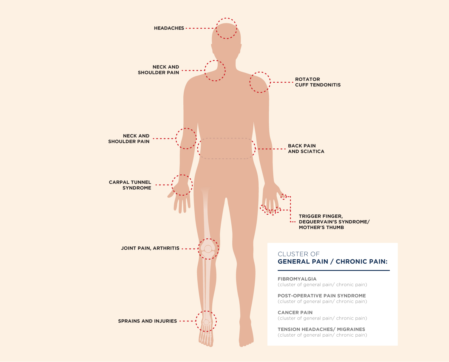 common acute and chronic pain issues such as back pain and other medical conditions associated