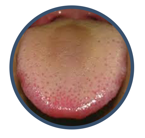 red tongue