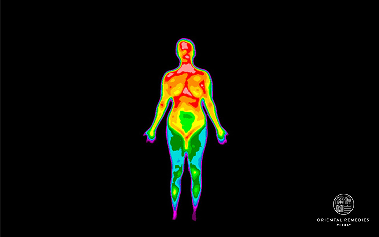Thermography Body Heat Map-tcm clinic singapore