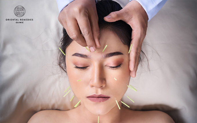 Facial Acupuncture for skin rejuvenation treatment