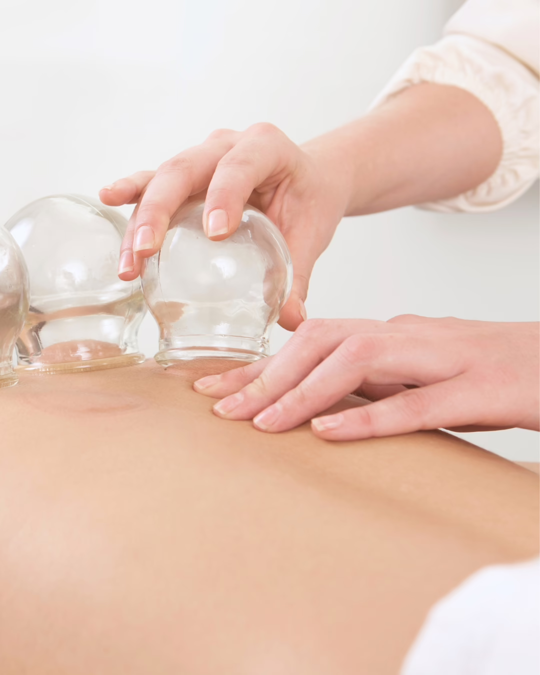 Pain_08CUPPING