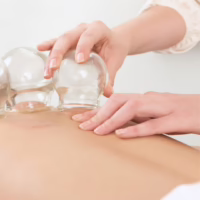 Pain_08CUPPING